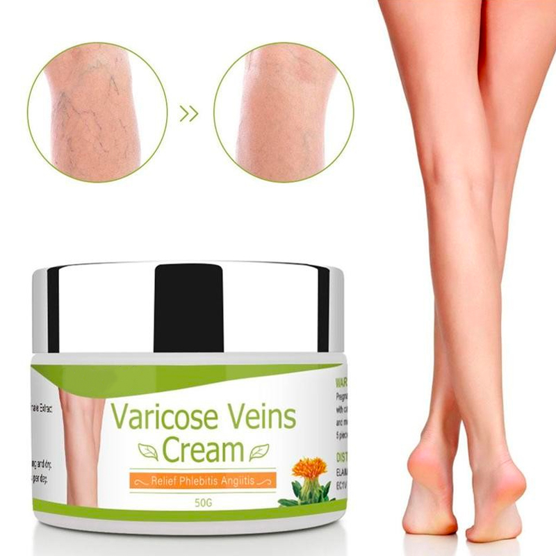 Varicose Veins Healing Cream