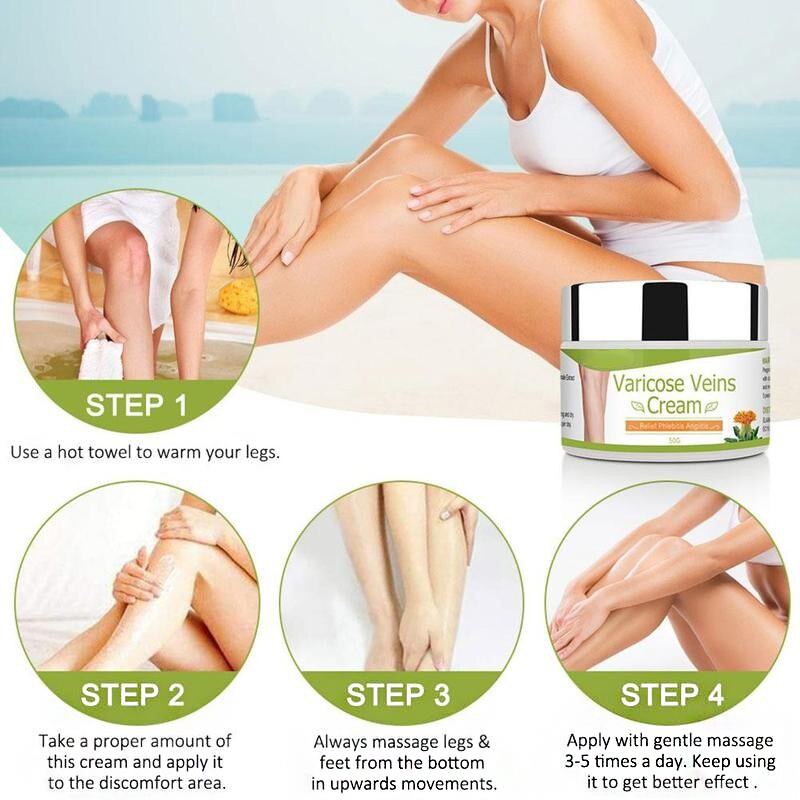 Varicose Veins Healing Cream